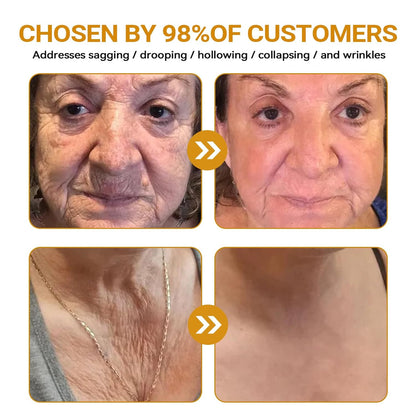 Bee VenomGlow™ Anti-Aging Cream ( 𝐂𝐚𝐬𝐡 𝐎𝐧 𝐃𝐞𝐥𝐢𝐯𝐞𝐫𝐲 )