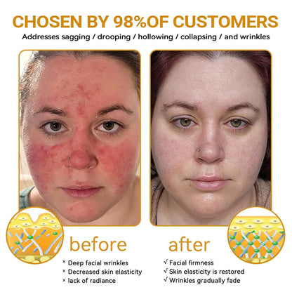 Bee VenomGlow™ Anti-Aging Cream ( 𝐂𝐚𝐬𝐡 𝐎𝐧 𝐃𝐞𝐥𝐢𝐯𝐞𝐫𝐲 )