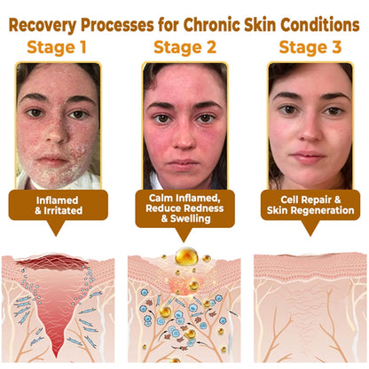 Bee VenomGlow™ Anti-Aging Cream ( 𝐂𝐚𝐬𝐡 𝐎𝐧 𝐃𝐞𝐥𝐢𝐯𝐞𝐫𝐲 )